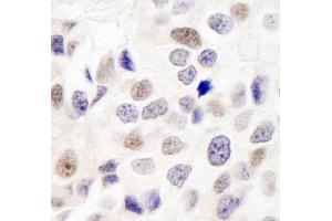 Immunohistochemistry (IHC) image for anti-Integrator Complex Subunit 7 (INTS7) (AA 850-900) antibody (ABIN7449405) (INTS7 Antikörper  (AA 850-900))