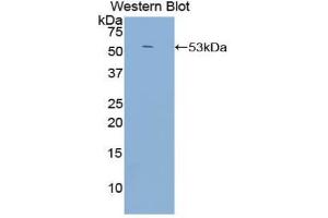 Western blot analysis of the recombinant protein. (CD21 Antikörper  (AA 729-957))