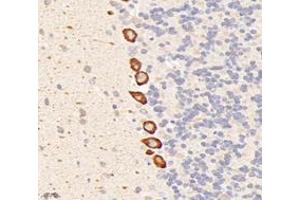 Immunohistochemistry analysis of paraffin-embedded rat cerebellum using,Dgkz (ABIN7073722) at dilution of 1: 6000 (DGKZ Antikörper)
