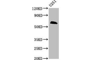Western Blot Positive WB detected in: U251 whole cell lysate All lanes: MSL2 antibody at 5 μg/mL Secondary Goat polyclonal to rabbit IgG at 1/50000 dilution Predicted band size: 63, 55 kDa Observed band size: 63 kDa (MSL2 Antikörper  (AA 341-473))