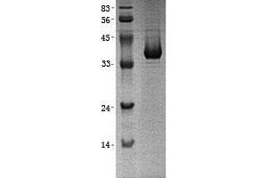 Western Blotting (WB) image for Lactate Dehydrogenase B (LDHB) (Transcript Variant 2) protein (His tag) (ABIN2724575)