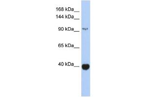 WB Suggested Anti-ZBTB4 Antibody Titration: 0. (ZBTB4 Antikörper  (Middle Region))