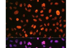 Immunofluorescence analysis of U-2 OS cells using Phospho-Histone H3(S10) Polyclonal Antibody at dilution of 1:100 (40x lens).