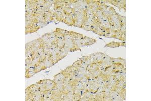 Immunohistochemistry (IHC) image for anti-Hexokinase 2 (HK2) (AA 1-120) antibody (ABIN3021256)