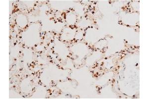 Immunohistochemistry (IHC) image for anti-Spleen tyrosine Kinase (SYK) (pTyr525) antibody (ABIN6255944)