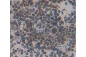 IHC-P analysis of Mouse Tissue, with DAB staining. (LMYC Antikörper  (AA 186-439))