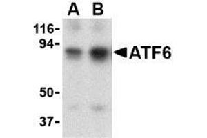 Western blot analysis of ATF6 in MDA-MB-361 cell lysate with this product atF6 antibody at (A) 0.