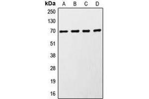 Western blot analysis of S6K1 expression in MCF7 (A), HeLa (B), HEK293 (C), mouse brain (D) whole cell lysates. (RPS6KB1 Antikörper  (C-Term))