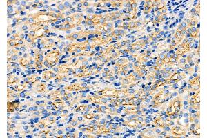 ABIN6260054 and ABIN6272249 at 1/100 staining Mouse kidney tissue by IHC-P. (ARRDC1 Antikörper  (C-Term))