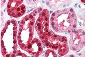 Human Kidney (formalin-fixed, paraffin-embedded) stained with CA2 antibody ABIN214579 at 5 ug/ml followed by biotinylated goat anti-rabbit IgG secondary antibody ABIN481713, alkaline phosphatase-streptavidin and chromogen. (CA2 Antikörper)