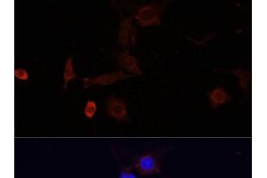 Immunofluorescence analysis of PC12 cells using WDR81 Polyclonal Antibody at dilution of 1:100. (WDR81 Antikörper)