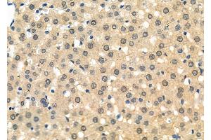 ABIN6264613 and ABIN6277733 at 1/100 staining Rat liver tissue by IHC-P.
