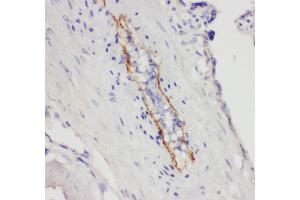 Immunohistochemistry (IHC) image for anti-Selectin P (Granule Membrane Protein 140kDa, Antigen CD62) (SELP) (AA 49-66), (N-Term) antibody (ABIN3044277)