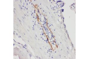 Anti- CD62P antibody, IHC(P) IHC(P): Human Placenta Tissue