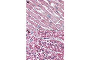 Immunohistochemical (Formalin/PFA-fixed paraffin-embedded sections) staining in human heart (A) and human adrenal gland (B) with SSTR5 polyclonal antibody . (SSTR5 Antikörper  (2nd Extracellular Domain))
