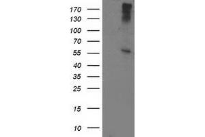 Western Blotting (WB) image for anti-ATPase, H+ Transporting, Lysosomal 56/58kDa, V1 Subunit B1 (ATP6V1B1) antibody (ABIN1496775) (ATP6V1B1 Antikörper)