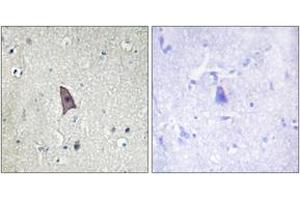 Immunohistochemistry analysis of paraffin-embedded human brain, using TIE2 (Phospho-Tyr1102) Antibody. (TEK Antikörper  (pTyr1102))