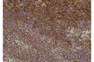 ABIN6276416 at 1/100 staining Mouse spleen tissue by IHC-P. (TRAF2 Antikörper  (C-Term))