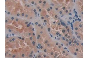 Detection of PTI in Human Kidney Tissue using Polyclonal Antibody to Placental Thrombin Inhibitor (PTI)