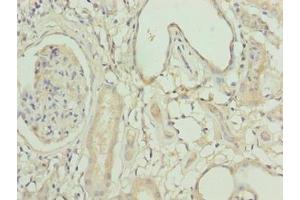 Immunohistochemistry of paraffin-embedded human kidney tissue using ABIN7158525 at dilution of 1:100 (ACSBG1 Antikörper  (AA 351-600))
