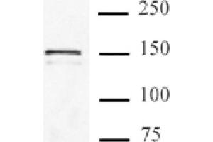 Cas9 antibody (mAb) tested by Immunoprecipitation. (CRISPR-Cas9 (N-Term) Antikörper)