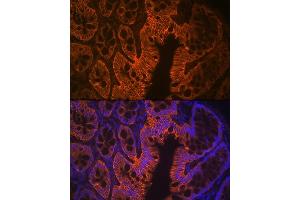 Immunofluorescence (IF) image for anti-LI Cadherin antibody (ABIN7268249)