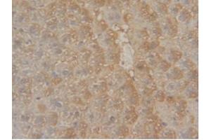 IHC-P analysis of Mouse Liver Tissue, with DAB staining. (GSTM1 Antikörper  (AA 1-218))