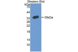 Western blot analysis of the recombinant protein. (RCN2 Antikörper  (AA 26-301))