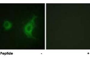 Immunofluorescence analysis of HUVEC cells, using KIF20A polyclonal antibody . (KIF20A Antikörper)