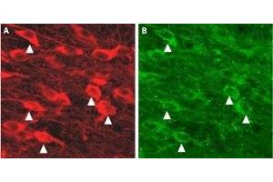 Expression of KCa2. (Small Conductance Calcium-Activated Potassium Channel Protein 3 (KCNN3) (N-Term) Peptid)