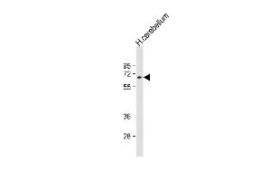 Anti-UGT2B4 Antibody (Center)at 1:2000 dilution + human cerebellum lysates Lysates/proteins at 20 μg per lane.