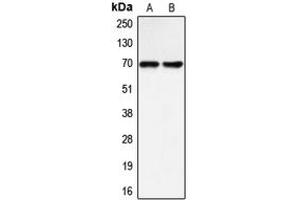 Western blot analysis of BLNK expression in Raji (A), LOVO (B) whole cell lysates. (B-Cell Linker Antikörper  (Center))