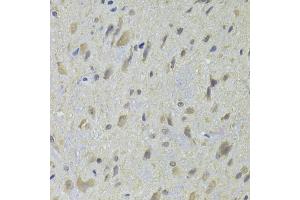 Immunohistochemistry of paraffin-embedded rat spinal cord using HDAC4 Antibody (ABIN5975864) at dilution of 1/100 (40x lens). (HDAC4 Antikörper)