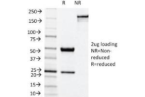 SDS-PAGE Analysis Purified NOX4 Mouse Monoclonal Antibody (NOX4/1245). (NADPH Oxidase 4 Antikörper)