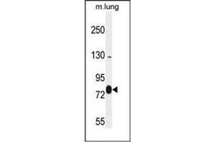 Western blot analysis of EXOC8 Antibody (Center) in mouse lung tissue lysates (35ug/lane).