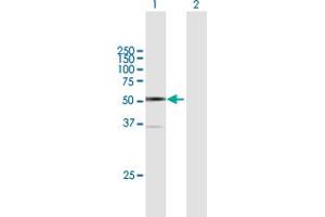 Western Blot analysis of ARC expression in transfected 293T cell line by ARC MaxPab polyclonal antibody. (ARC (AA 1-396) Antikörper)