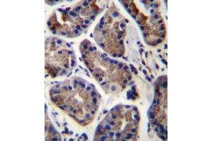 SLC9A2 Antibody immunohistochemistry analysis in formalin fixed and paraffin embedded human stomach tissue followed by peroxidase conjugation of the secondary antibody and DAB staining. (SLC9A2 Antikörper  (C-Term))