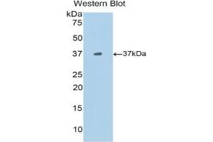 Western blot analysis of the recombinant protein. (CXCL13 Antikörper  (AA 22-109))