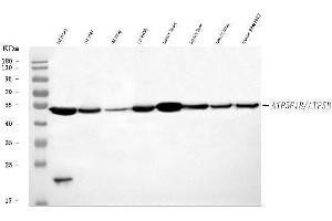 Western blot analysis of ATP5F1B using anti-ATP5F1B antibody (ABIN7599866). (Atp5f1b (AA 123-529) Antikörper)