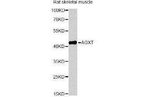Western blot analysis of extracts of rat skeletal muscle, using AGXT antibody (ABIN6291533) at 1:1000 dilution. (AGXT Antikörper)