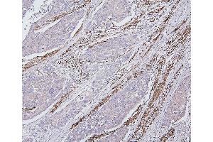 IHC analysis of Desmin using anti-Desmin antibody (ABIN7599249).