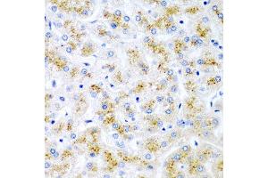 Immunohistochemistry of paraffin-embedded human liver injury using WNT2 antibody at dilution of 1:200 (40x lens). (WNT2 Antikörper)