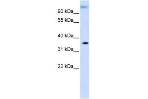 WB Suggested Anti-DHDH Antibody Titration: 0. (DHDH Antikörper  (Middle Region))