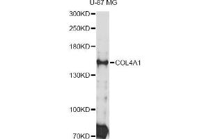 Western blot analysis of extracts of U-87 MG cells, using COL4A1 Antibody (ABIN5997482) at 1:3000 dilution. (COL4A1 Antikörper)