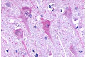Anti-P2RY8 / P2Y8 antibody  ABIN1049223 IHC staining of human brain, neurons and glia. (P2RY8 Antikörper  (C-Term))