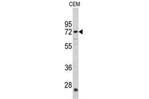 Image no. 1 for anti-Carnitine O-Acetyltransferase (CRAT) (N-Term) antibody (ABIN452873) (CRAT Antikörper  (N-Term))