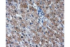 Immunohistochemical staining of paraffin-embedded liver tissue using anti-LEMD3mouse monoclonal antibody. (LEMD3 Antikörper)