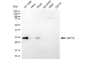 Western blotting analysis using GSTT2 antibody (ABIN7798759). (GSTT2 Antikörper)
