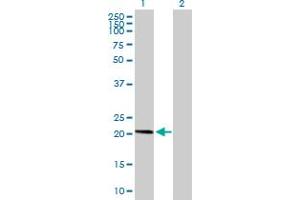 Western Blot analysis of AP3S1 expression in transfected 293T cell line by AP3S1 MaxPab polyclonal antibody. (AP3S1 Antikörper  (AA 1-193))