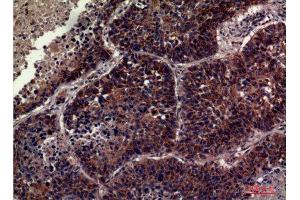 Immunohistochemistry (IHC) analysis of paraffin-embedded Human Lung, antibody was diluted at 1:100.